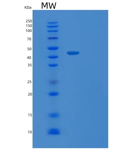SDS-PAGE analysis of Human TARDBP (Tar Dna-Binding Protein 43) - Recombinant Protein, CAT# BLT-08404P showing >95% purity under 15% SDS-PAGE (Reduced)