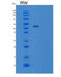 SDS-PAGE analysis of Human TARDBP (Tar Dna-Binding Protein 43) - Recombinant Protein, CAT# BLT-08404P showing >95% purity under 15% SDS-PAGE (Reduced)