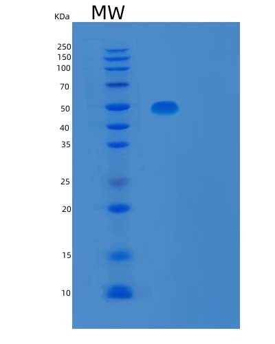 SDS-PAGE analysis of Human TBCEL (Tubulin-Specific Chaperone Cofactor E-Like Protein) - Recombinant Protein, showing >90% purity under 15% SDS-PAGE (Reduced)