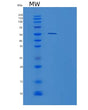SDS-PAGE analysis of Human TINAGL1 (Tubulointerstitial Nephritis Antigen-Like) - Recombinant Protein, showing >90% purity under 15% SDS-PAGE (Reduced)