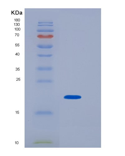 SDS-PAGE analysis of Human TSG101 (Tumor Susceptibility Gene 101 Protein) - Recombinant Protein, showing >90% purity under 15% SDS-PAGE (Reduced)