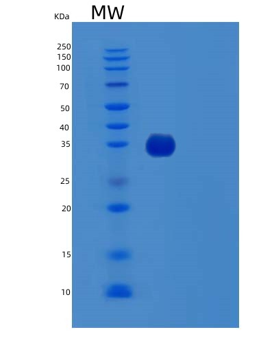 SDS-PAGE analysis of Human TTC1 (Tetratricopeptide Repeat Protein 1) - Recombinant Protein, showing >85% purity under 15% SDS-PAGE (Reduced)