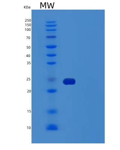 SDS-PAGE analysis of Human TNFRSF1B (Tumor Necrosis Factor Receptor Superfamily Member 1B) - Recombinant Protein, showing >95% purity under 15% SDS-PAGE (Reduced)