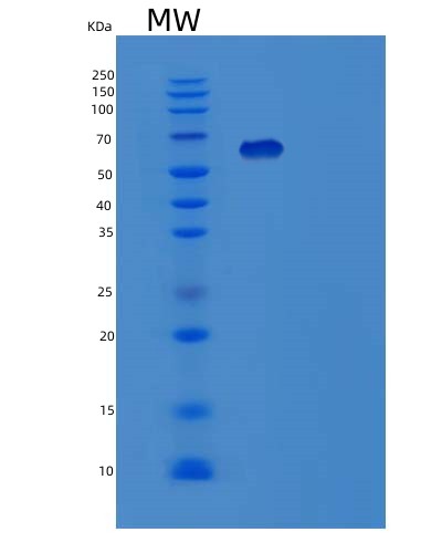 SDS-PAGE analysis of Human YARS1 (Tyrosine--Trna Ligase, Cytoplasmic) - Recombinant Protein, showing >85% purity under 15% SDS-PAGE (Reduced)