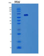 SDS-PAGE analysis of Human YARS1 (Tyrosine--Trna Ligase, Cytoplasmic) - Recombinant Protein, showing >85% purity under 15% SDS-PAGE (Reduced)