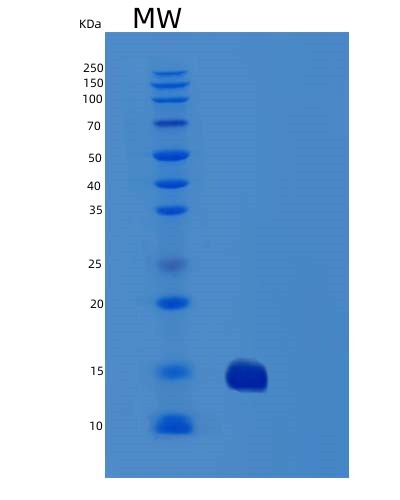 SDS-PAGE analysis of Human TNFRSF10B (Tumor Necrosis Factor Receptor Superfamily Member 10B) - Recombinant Protein, showing >90% purity under 15% SDS-PAGE (Reduced)