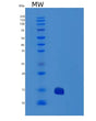 SDS-PAGE analysis of Human TNFRSF10B (Tumor Necrosis Factor Receptor Superfamily Member 10B) - Recombinant Protein, showing >90% purity under 15% SDS-PAGE (Reduced)