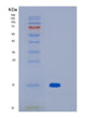SDS-PAGE analysis of Human MOG (Myelin-Oligodendrocyte Glycoprotein) - Recombinant Protein, showing >85% purity under 15% SDS-PAGE (Reduced)