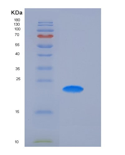 SDS-PAGE analysis of Human FCGR2A (Low Affinity Immunoglobulin Gamma Fc Region Receptor Ii-A) - Recombinant Protein, showing >90% purity under 15% SDS-PAGE (Reduced)