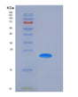 SDS-PAGE analysis of Human FCGR2A (Low Affinity Immunoglobulin Gamma Fc Region Receptor Ii-A) - Recombinant Protein, showing >90% purity under 15% SDS-PAGE (Reduced)