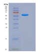 SDS-PAGE analysis of Human PSAP (Prosaposin) - Recombinant Protein, showing >95% purity under 15% SDS-PAGE (Reduced)