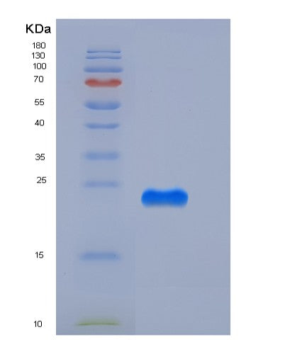SDS-PAGE analysis of Mouse Creg1 (Protein Creg1) - Recombinant Protein, showing >95% purity under 15% SDS-PAGE (Reduced)