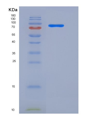 SDS-PAGE analysis of Human AKT3 (Rac-Gamma Serine/Threonine-Protein Kinase) - Recombinant Protein, showing >85% purity under 15% SDS-PAGE (Reduced)