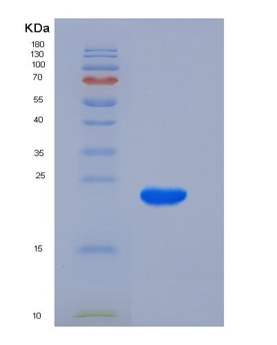 SDS-PAGE analysis of Human KRAS (Gtpase Kras) - Recombinant Protein, showing >95% purity under 15% SDS-PAGE (Reduced)