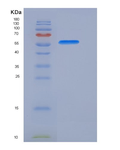 SDS-PAGE analysis of Human AKT1 (Rac-Alpha Serine/Threonine-Protein Kinase) - Recombinant Protein, showing >90% purity under 15% SDS-PAGE (Reduced)