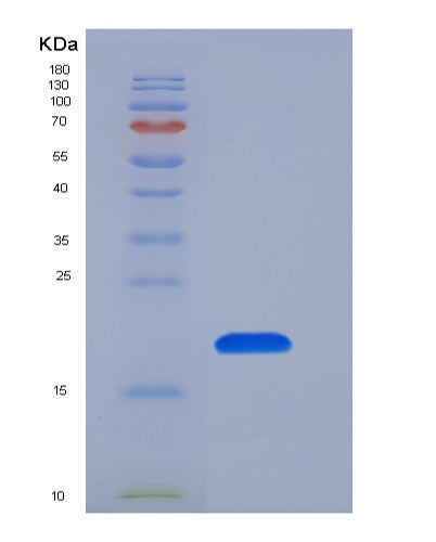 SDS-PAGE analysis of Human GKN1 (Gastrokine-1) - Recombinant Protein, showing >90% purity under 15% SDS-PAGE (Reduced)