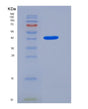 SDS-PAGE analysis of Mouse Acp3 (Prostatic Acid Phosphatase) - Recombinant Protein, showing >95% purity under 15% SDS-PAGE (Reduced)
