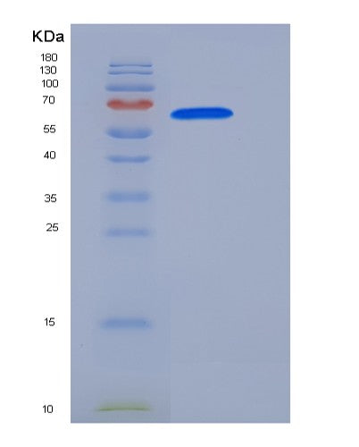 SDS-PAGE analysis of Human FAM20C (Extracellular Serine/Threonine Protein Kinase Fam20C) - Recombinant Protein, showing >90% purity under 15% SDS-PAGE (Reduced)