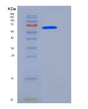 SDS-PAGE analysis of Human FAM20C (Extracellular Serine/Threonine Protein Kinase Fam20C) - Recombinant Protein, showing >90% purity under 15% SDS-PAGE (Reduced)