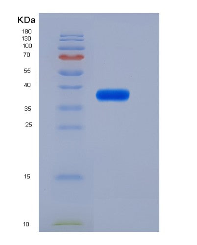 SDS-PAGE analysis of Mouse Il6ra (Interleukin-6 Receptor Subunit Alpha) - Recombinant Protein, showing >85% purity under 15% SDS-PAGE (Reduced)