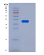 SDS-PAGE analysis of Mouse Il6ra (Interleukin-6 Receptor Subunit Alpha) - Recombinant Protein, showing >85% purity under 15% SDS-PAGE (Reduced)