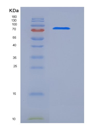 SDS-PAGE analysis of Human MEGF10 (Multiple Epidermal Growth Factor-Like Domains Protein 10) - Recombinant Protein, showing >85% purity under 15% SDS-PAGE (Reduced)