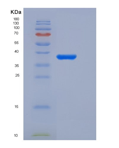 SDS-PAGE analysis of Human ACYP2 (Acylphosphatase-2) - Recombinant Protein, showing >90% purity under 15% SDS-PAGE (Reduced)