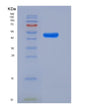 SDS-PAGE analysis of Human LILRA5 (Leukocyte Immunoglobulin-Like Receptor Subfamily A Member 5) - Recombinant Protein, showing >85% purity under 15% SDS-PAGE (Reduced)