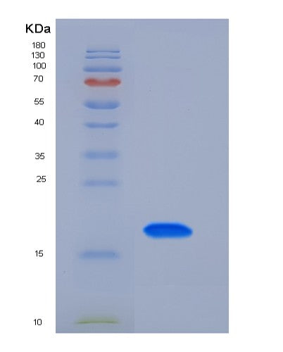 SDS-PAGE analysis of Mouse Tfpi2 (Tissue Factor Pathway Inhibitor 2) - Recombinant Protein, showing >90% purity under 15% SDS-PAGE (Reduced)