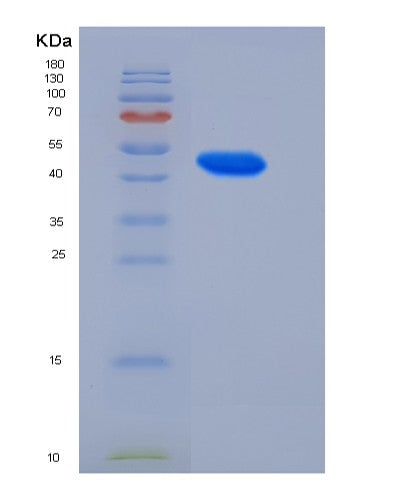 SDS-PAGE analysis of Human GADD45A (Growth Arrest And Dna Damage-Inducible Protein Gadd45 Alpha) - Recombinant Protein, showing >85% purity under 15% SDS-PAGE (Reduced)
