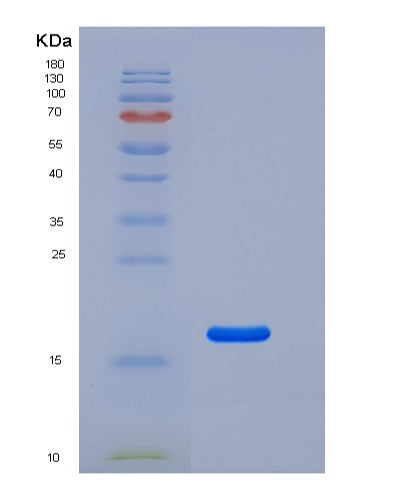 SDS-PAGE analysis of Human CD69 (Early Activation Antigen Cd69) - Recombinant Protein, showing >95% purity under 15% SDS-PAGE (Reduced)