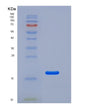 SDS-PAGE analysis of Human CD69 (Early Activation Antigen Cd69) - Recombinant Protein, showing >95% purity under 15% SDS-PAGE (Reduced)