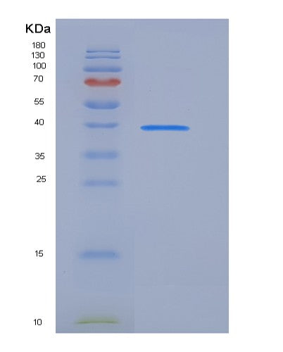 SDS-PAGE analysis of Human SFRP4 (Secreted Frizzled-Related Protein 4) - Recombinant Protein, showing >90% purity under 15% SDS-PAGE (Reduced)