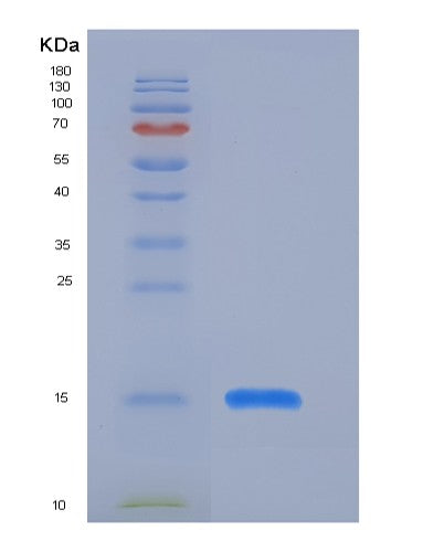 SDS-PAGE analysis of Human PSAP (Prosaposin) - Recombinant Protein, showing >85% purity under 15% SDS-PAGE (Reduced)