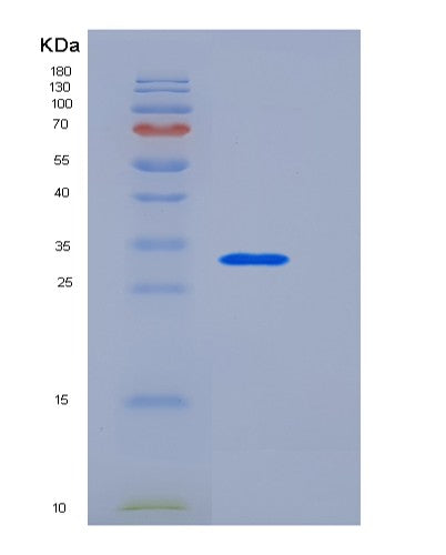 SDS-PAGE analysis of Human APP (Amyloid-Beta Precursor Protein) - Recombinant Protein, CAT# BLT-08421P showing >90% purity under 15% SDS-PAGE (Reduced)