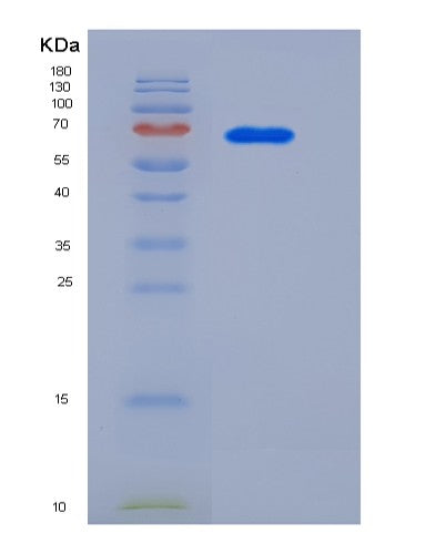 SDS-PAGE analysis of Human AFP (Alpha-Fetoprotein) - Recombinant Protein, showing >85% purity under 15% SDS-PAGE (Reduced)