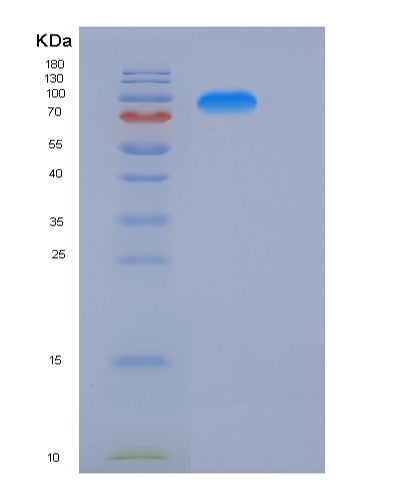 SDS-PAGE analysis of Human KIFBP (Kif-Binding Protein) - Recombinant Protein, showing >90% purity under 15% SDS-PAGE (Reduced)