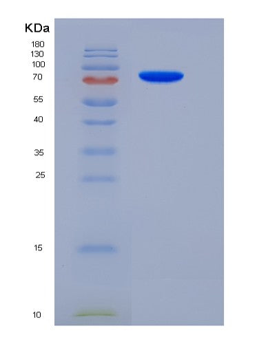 SDS-PAGE analysis of Mouse Sema5a (Semaphorin-5A) - Recombinant Protein, showing >90% purity under 15% SDS-PAGE (Reduced)