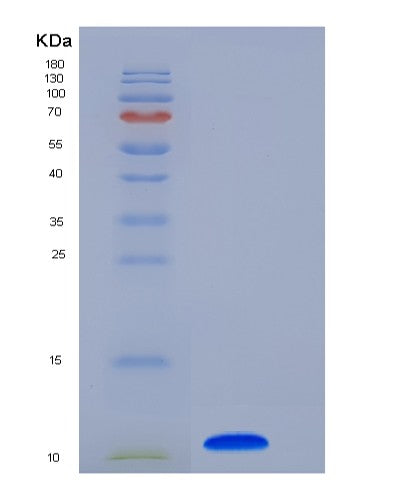 SDS-PAGE analysis of Human COL6A3 (Collagen Alpha-3(Vi) Chain) - Recombinant Protein, showing >85% purity under 15% SDS-PAGE (Reduced)