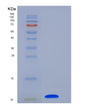 SDS-PAGE analysis of Human COL6A3 (Collagen Alpha-3(Vi) Chain) - Recombinant Protein, showing >85% purity under 15% SDS-PAGE (Reduced)