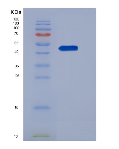 SDS-PAGE analysis of Human SERPINI1 (Neuroserpin) - Recombinant Protein, showing >95% purity under 15% SDS-PAGE (Reduced)