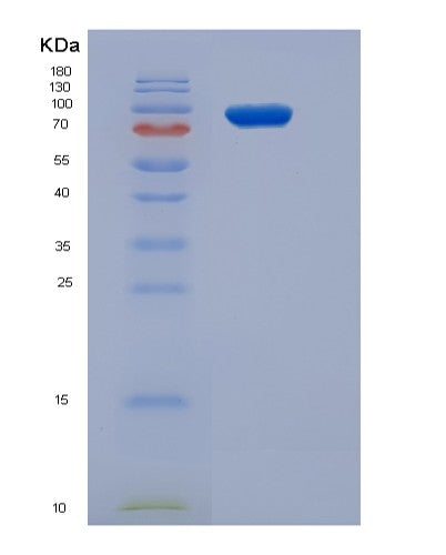 SDS-PAGE analysis of Human SRPK3 (Srsf Protein Kinase 3) - Recombinant Protein, showing >85% purity under 15% SDS-PAGE (Reduced)