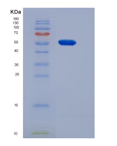SDS-PAGE analysis of Mouse Cndp1 (Beta-Ala-His Dipeptidase) - Recombinant Protein, showing >90% purity under 15% SDS-PAGE (Reduced)