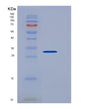 SDS-PAGE analysis of Human PCNA (Proliferating Cell Nuclear Antigen) - Recombinant Protein, showing >90% purity under 15% SDS-PAGE (Reduced)