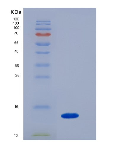 SDS-PAGE analysis of Mouse B2m (Beta-2-Microglobulin) - Recombinant Protein, showing >85% purity under 15% SDS-PAGE (Reduced)