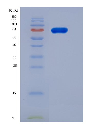 SDS-PAGE analysis of Human FAM20B (Glycosaminoglycan Xylosylkinase) - Recombinant Protein, showing >95% purity under 15% SDS-PAGE (Reduced)
