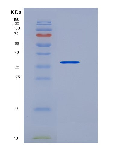 SDS-PAGE analysis of Human RAMP3 (Receptor Activity-Modifying Protein 3) - Recombinant Protein, showing >90% purity under 15% SDS-PAGE (Reduced)
