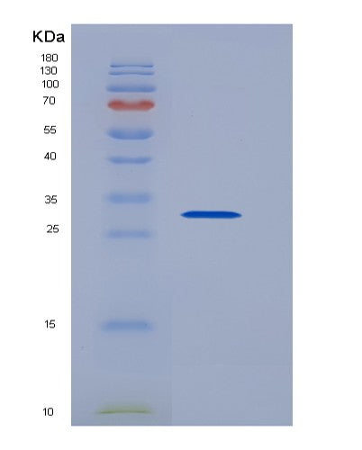 SDS-PAGE analysis of Human STATH (Statherin) - Recombinant Protein, showing >90% purity under 15% SDS-PAGE (Reduced)