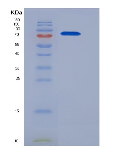 SDS-PAGE analysis of Human CBLC (E3 Ubiquitin-Protein Ligase Cbl-C) - Recombinant Protein, showing >85% purity under 15% SDS-PAGE (Reduced)