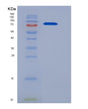 SDS-PAGE analysis of Human CBLC (E3 Ubiquitin-Protein Ligase Cbl-C) - Recombinant Protein, showing >85% purity under 15% SDS-PAGE (Reduced)